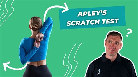 apley's scratch test positive